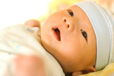 Bệnh vàng da sinh lý